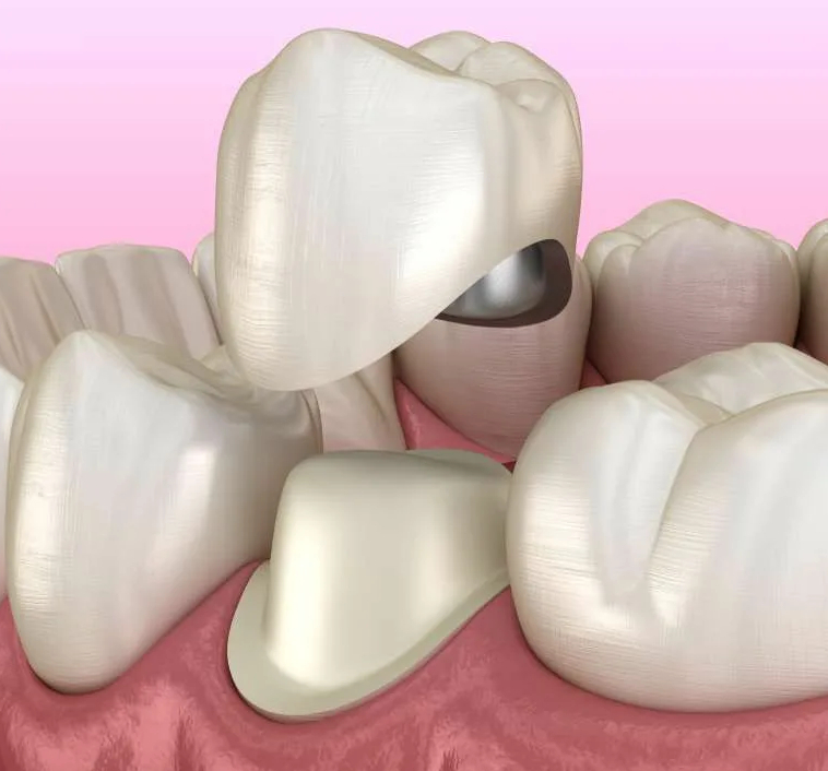Почему зуб болит от нажатия и что делать?